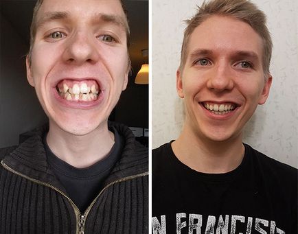 40 Дивних випадків, коли стоматологи творили чудеса