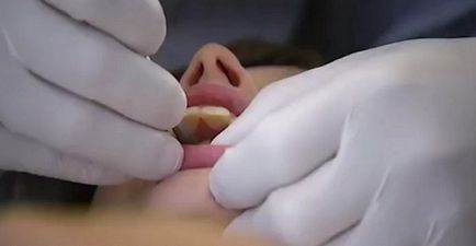 40 Cazuri uimitoare când stomatologii au făcut minuni
