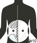 Acupunctura pentru artrita