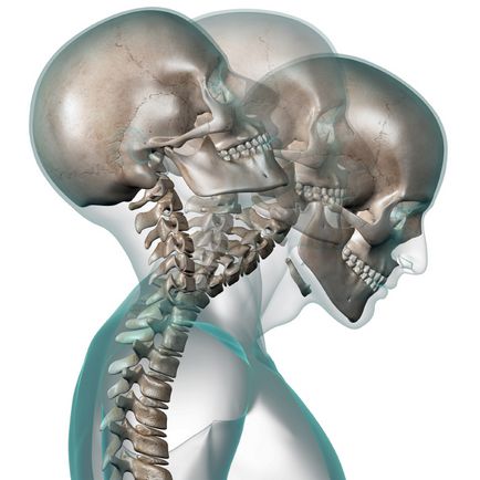 Ce îmi va arăta departamentul coloanei vertebrale cervicale