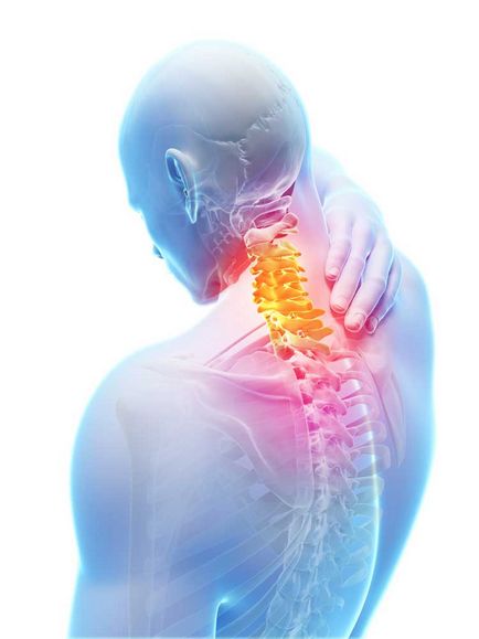Mi lesz az MRI-központ a nyaki gerinc (nyak) Mi lesz az MRI-központ nyaki gerinc