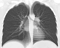 Mit jelent a CT, MRI (komputertomográfia) fény