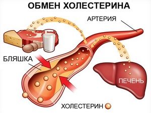 Ce este colesterolul și de unde provin plăcile de colesterol?