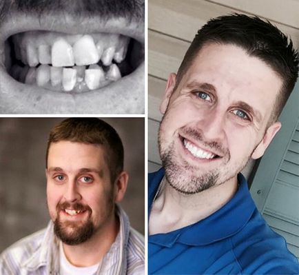 Чудеса сучасної стоматології (41 фото)