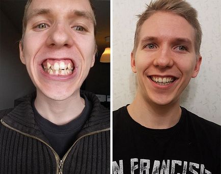 A csodák a modern fogászat (41 fotó)