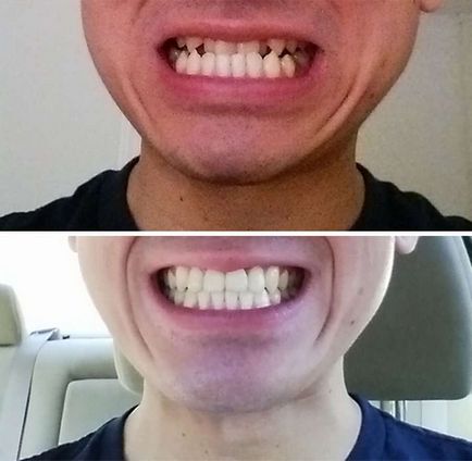 Чудеса сучасної стоматології (41 фото), чорт забирай