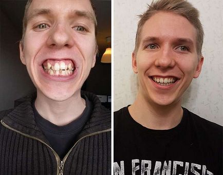 A csodák a modern fogászat (41 fotó) pokol