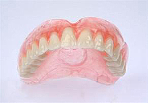 Dentalab - proteză termoplastică