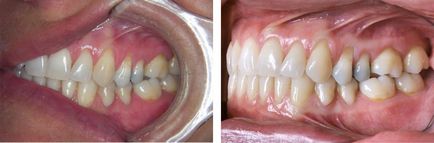 Fotografie dentară - stomatologie - știri și articole despre stomatologie - profesionale