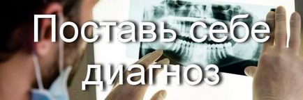 Diskoloratsiya fogszövetekkel kapott endodontális kezelés (kezelés) Diskoloratsiya fogszövetekkel kapott endodontikus