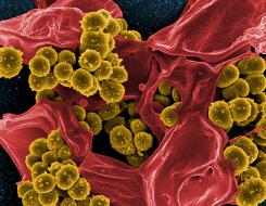 Prevenirea de urgență a infecțiilor virale respiratorii acute și a herpesului