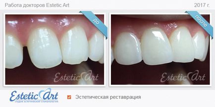 Естетична стоматологія в Запоріжжі