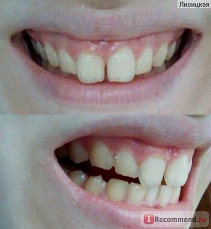 Estetica dentară estetică - restaurarea artei dinților - 