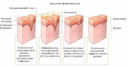 Фібробласти - що це таке, їх функції та чи можна їх відновити