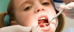Фторування молочних зубів, або глибоке фторування