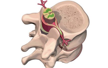 Hemangiomul coloanei vertebrale, clasificarea bolii, diagnosticul și tratamentul patologiei