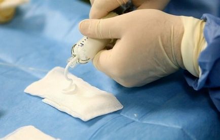 gerinc hemangioma, betegségek osztályozásának diagnózis és a kezelés a patológia (betegség) gerinc hemangioma, betegségek osztályozásának, a diagnózis és a kezelés a betegség