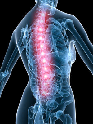 Гематомієлія спинного мозку - причини появи, симптоми і лікування