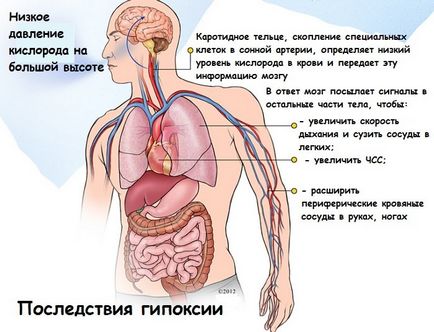 Hipoxia creierului cum să nu pierdeți această boală