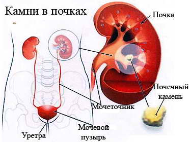 Cum rinichii sunt afectați de simptome la bărbați