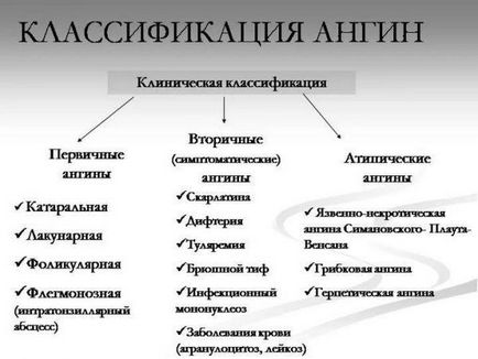 Як лікувати ангіну швидко у дорослого і дитини антибіотиками і народними засобами в домашніх