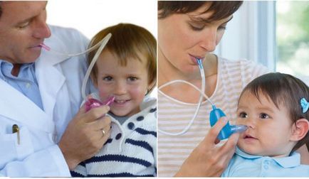 Как да изчистите слуз от носа на дете - че употребата