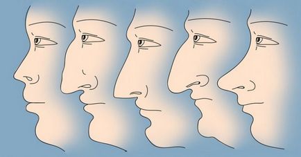 Cum de a determina natura formei nasului, informatka