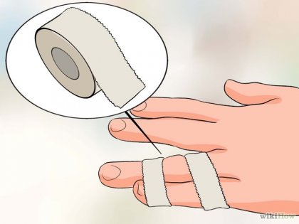 Cum să vindeci un deget strâns