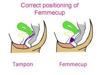 Cumpărați femmecup (femmecap, capac, menstruație, cupă menstruală, cupă menstruală