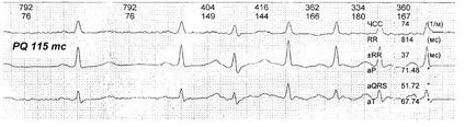 Лікувально-профілактичні заходи в корекції укороченого інтервалу pq і порушення роботи av