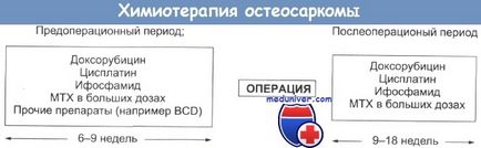 Лікування остеосаркоми і її ефективність