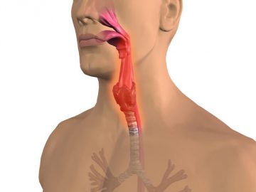 Akut és krónikus pharyngitis otthoni emberek jogorvoslatok