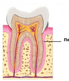 Tratamentul inflamației gingivale