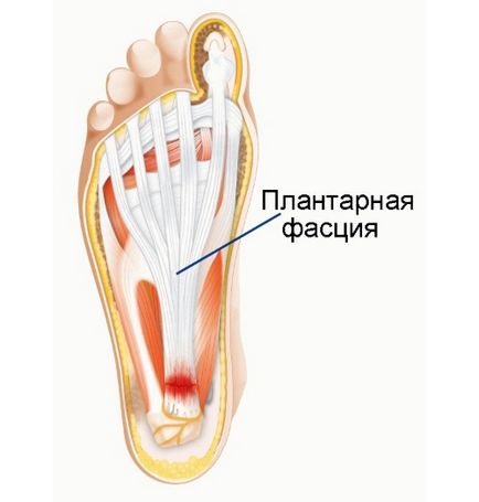 Masaj cu acul calcaneal la domiciliu