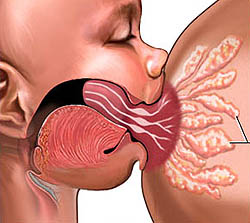 Mastita - cauze, simptome, diagnostic si tratament