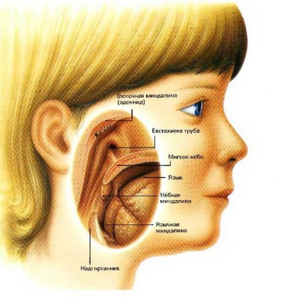 Amigdalele tratării gâtului copiilor, tratamentul copiilor