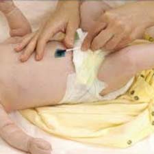 Este posibil să se spele copilul cu cordonul ombilical neprotejat