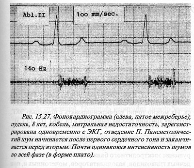 Insuficiența supapelor atrioventriculare (endocardioză) la câini