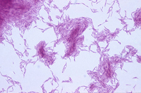 Micobacterii non-tuberculoase, ceea ce este micobacterioza non-tuberculoasă