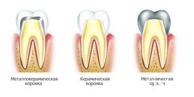 Ортопедична стоматологія що це таке
