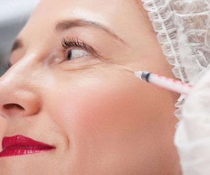 Umflare sub ochi după botox cauza, tratamentul și prevenirea