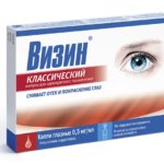 Сіпання верхньої повіки - небезпечно це, і які його причини