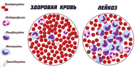 Переваги гематології ізраїлю