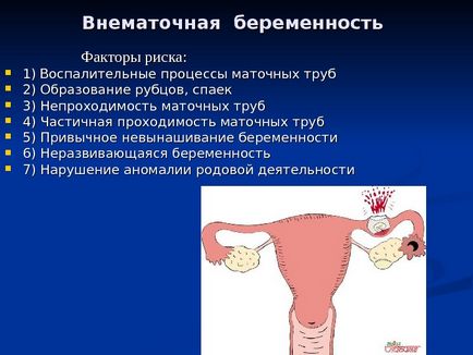 Curs de prezentare privind avortul ginecologic