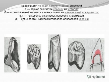 Prezentare pe tema lecturii4 subiecte metode ortopedice de tratare a ștergerii crescute - Karaganda