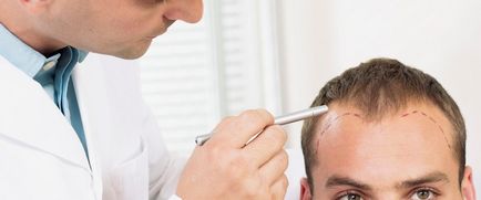 Coafuri pentru bărbați balding sunt o soluție simplă la problema delicată