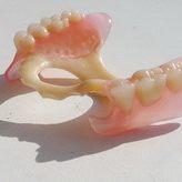 Протезування зубів без обточування варіанти і вартість