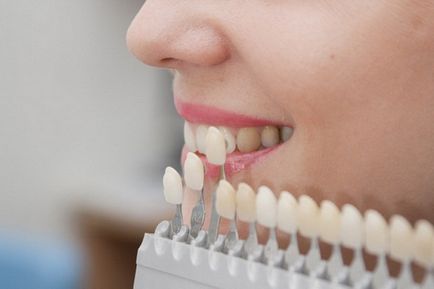 Restaurarea dinților, tipuri, indicații și contraindicații
