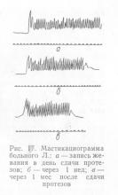 Livrarea de proteze, stomatologie ortopedică