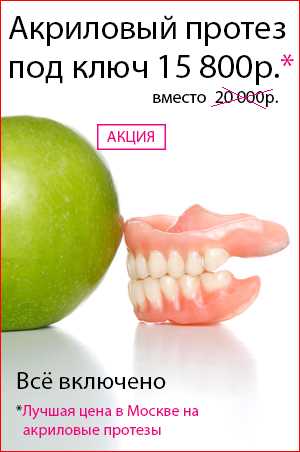 Знімні зубні протези, ціни в королев на протезування повними або частковими протезами,